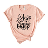 Yes it s a baby bump